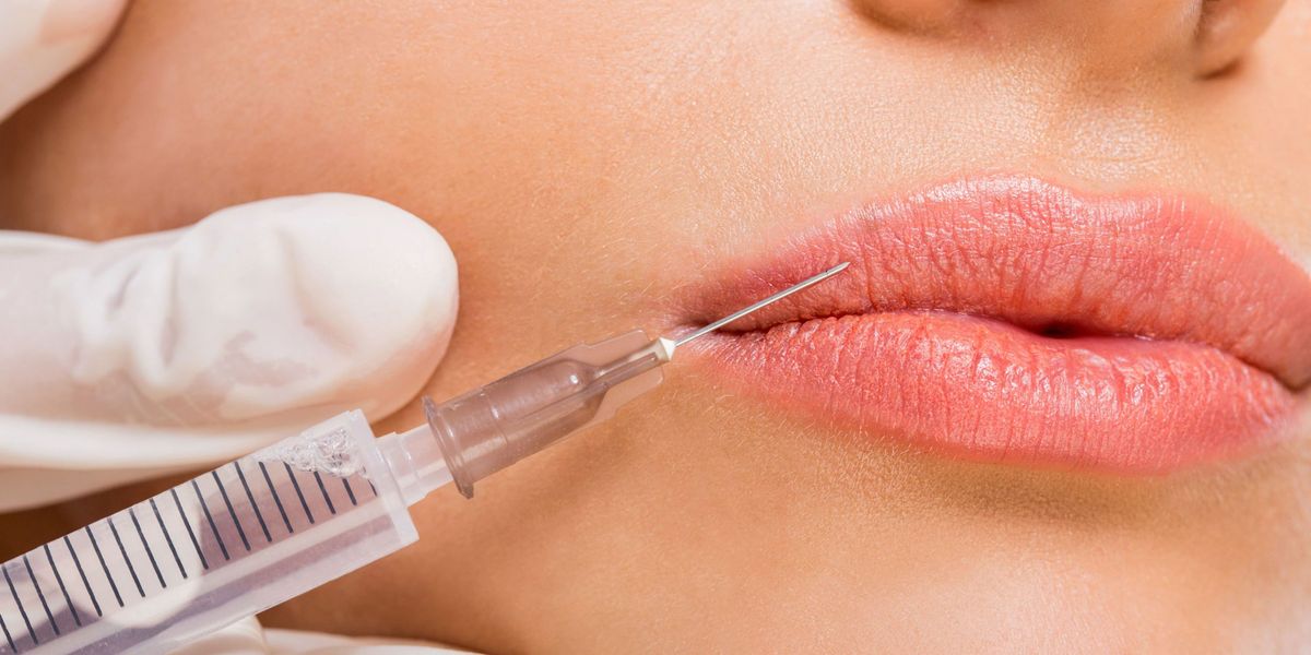 #BeautySchool: ماذا يحدث للشفاه بمجرد تحلل الفيلر؟
