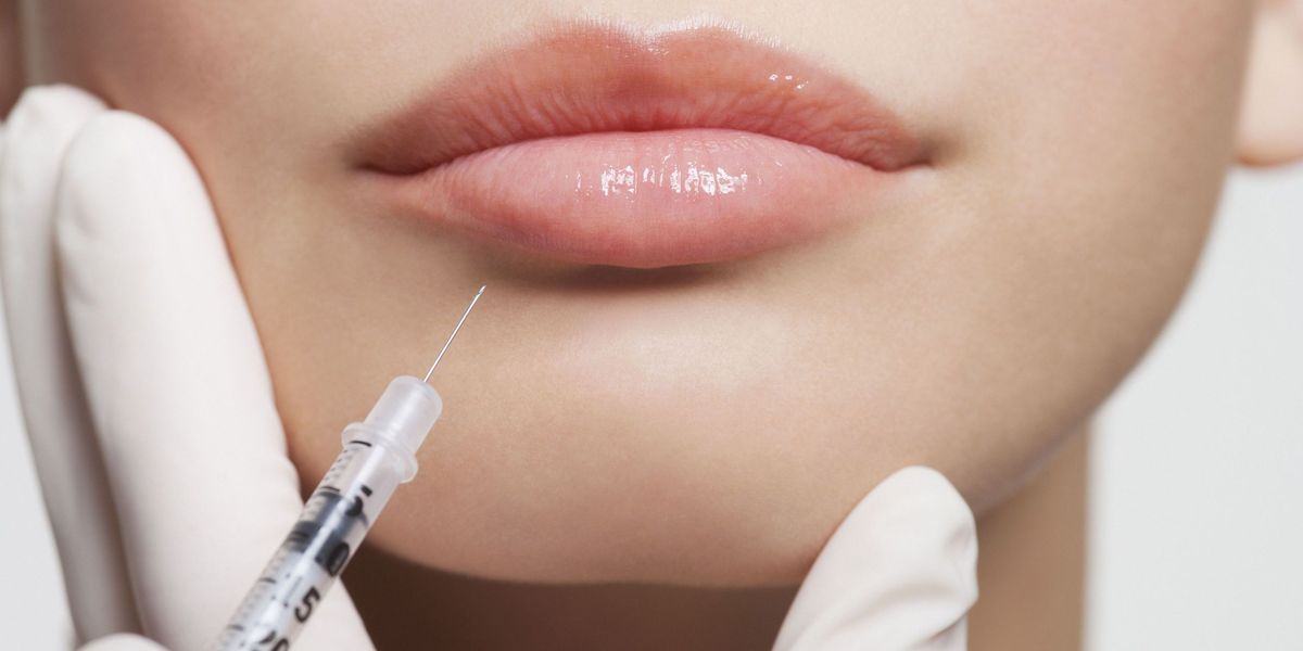 6 lugares surpreendentes onde você pode obter botox