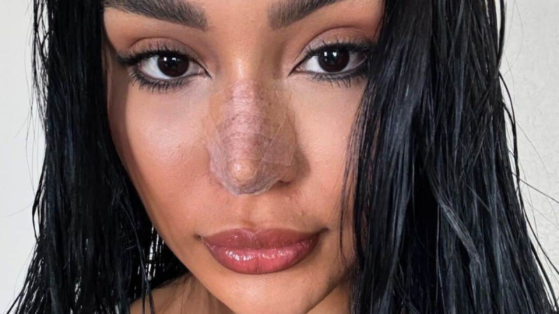   Thais Ramone tira selfie pós-cirurgia