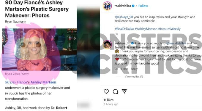   Ashley Martson comenta sobre seu cirurgião plástico's instagram post