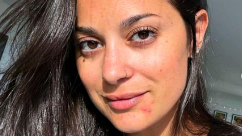 Loren Brovarnik erwägt eine zweite Fetttransplantation: „Ich wollte größere Brüste“