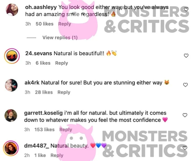  Captura de tela dos comentários do Instagram enquanto os fãs reagem à mudança de lábios de Cara Maria Sorbello