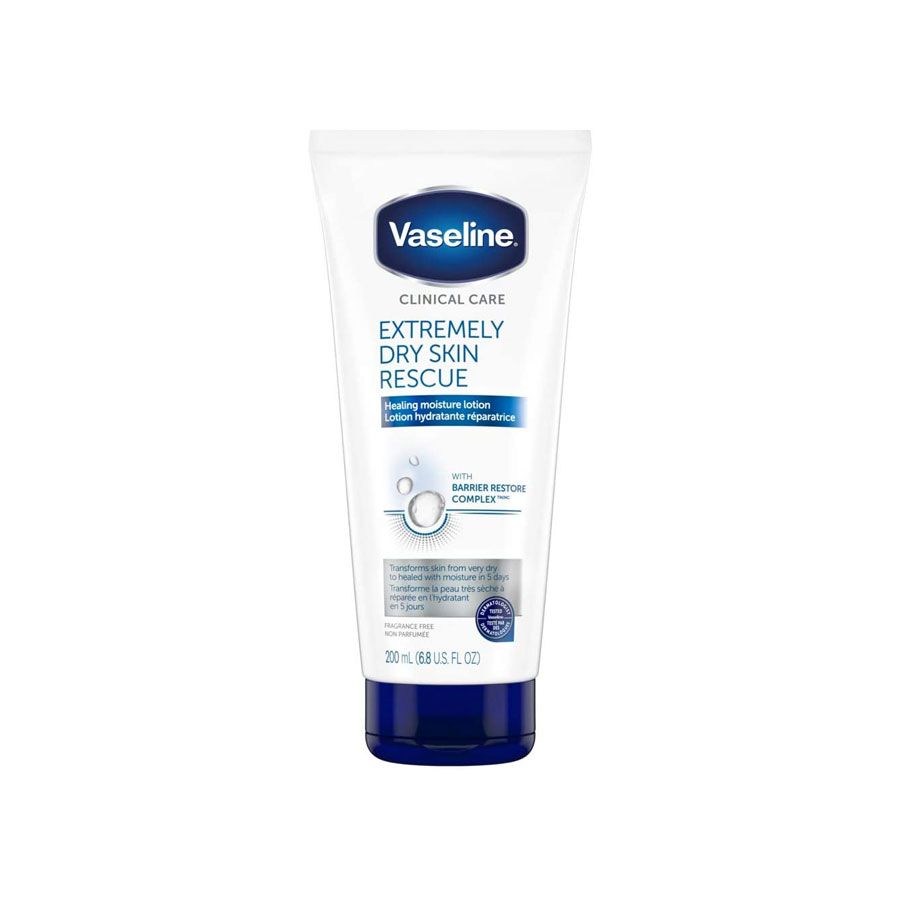 Teisingas būdas gydyti nudegimą, pasak dermatologo